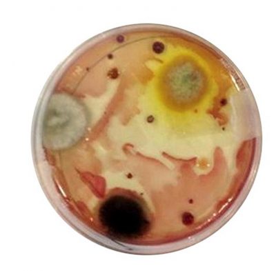 petri-dentista-pred-alta